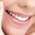 آیا جرم گیری دندان ضرر دارد؟