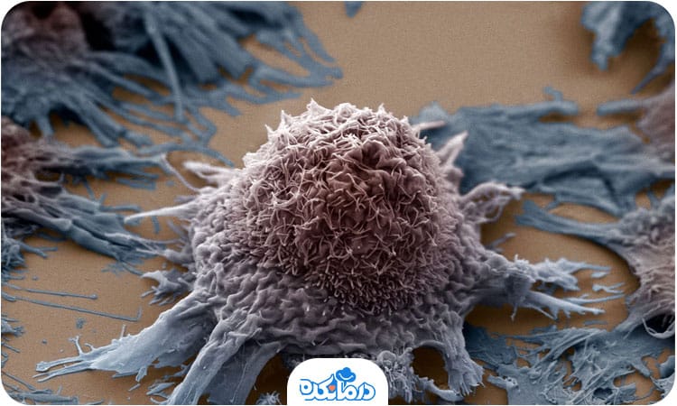 یک سلول سرطانی